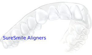 SureSmile Aligners